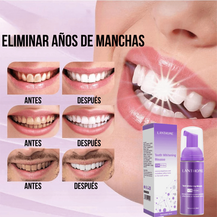 Blanqueamiento Dental LantHome Fresh White